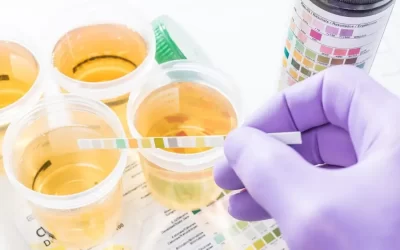 Understanding Proteinuria and Its Impact on Kidney Health